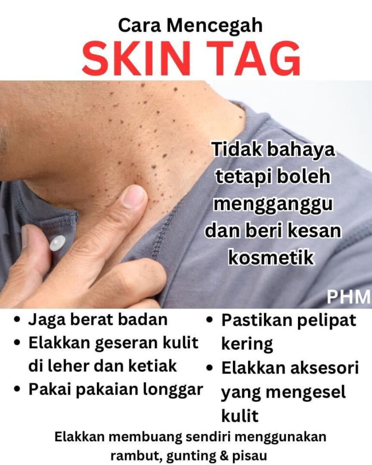 WhatsApp Image 2023 07 28 at 10.53.21 AM